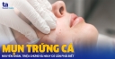 Mụn trứng cá: Nguyên nhân - Triệu chứng - Nguy cơ cần phải biết