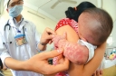 Những biến chứng của bệnh sởi