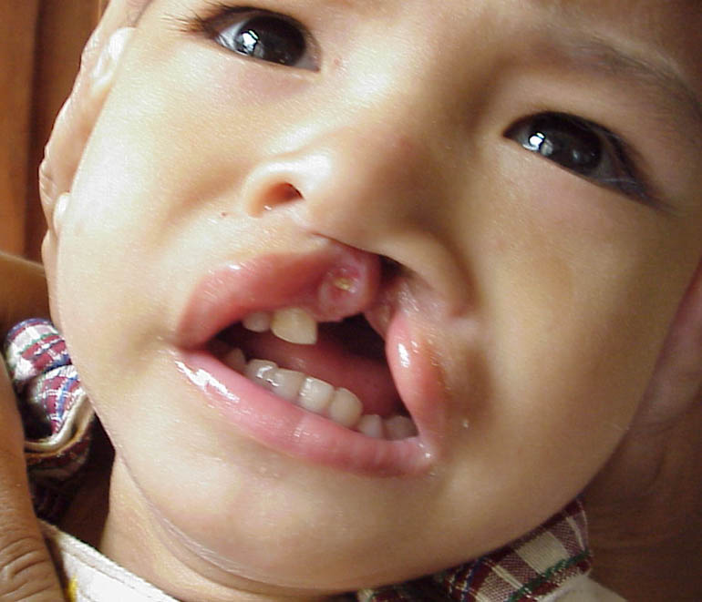 di tat thai nhi
